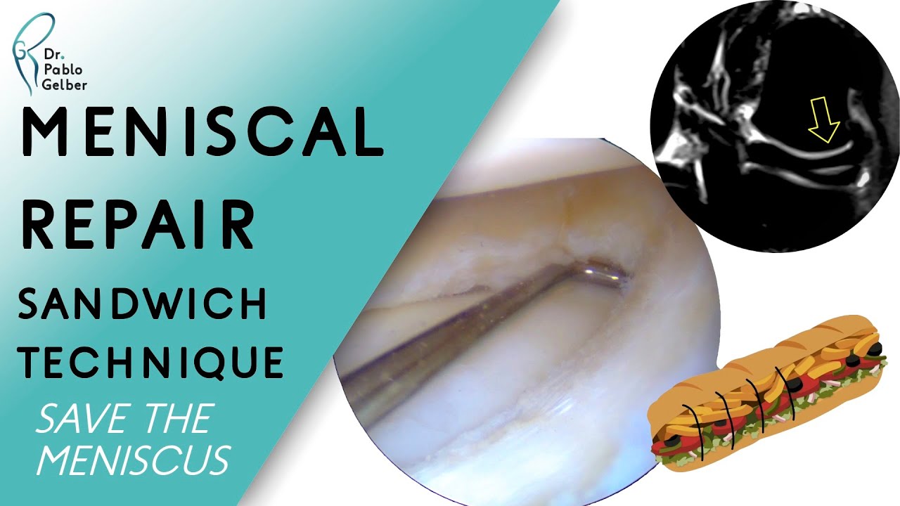 Pablo E. Gelber Ghertner-16