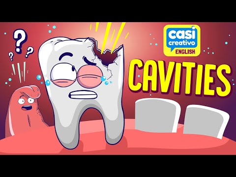 Cavities