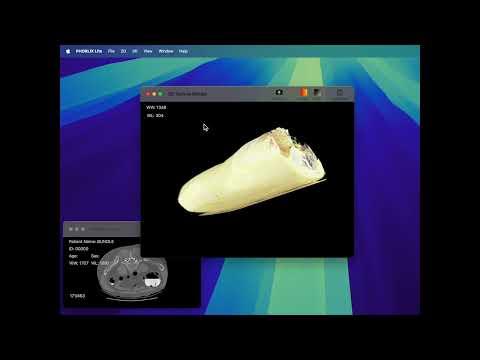 保健学科 PHORLIX Lite Ver1.0.5 -How To Use-