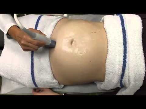 Advances in Ultrasound in Obst Video