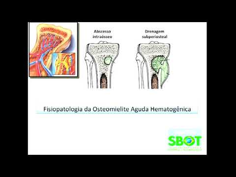 Anestezie pentru dureri în articulația genunchiului