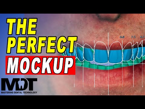 Mockup Smile Design Tutorial in Exocad Smile Creator