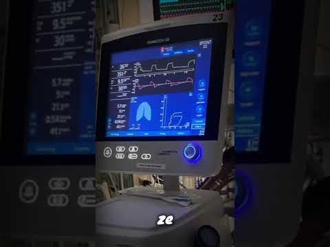 Dlaczego został włączony alarm w wywiadzie ze Stephenem  Hawkingiem ? #shorts #ciekawostk