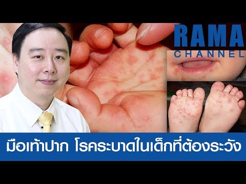 อาการ