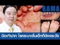 อาการ