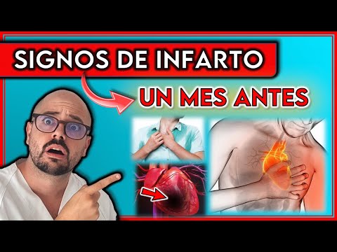 Conoce Los Principales Síntomas De Alerta Antes De Un Infarto