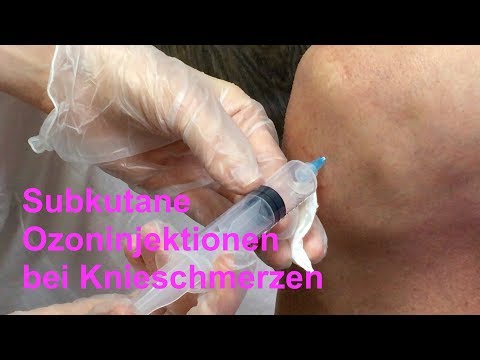 Schmerzen Knoten nach links am Hals Chondrose Behandlung von lumbosakralen Wirbelsäule