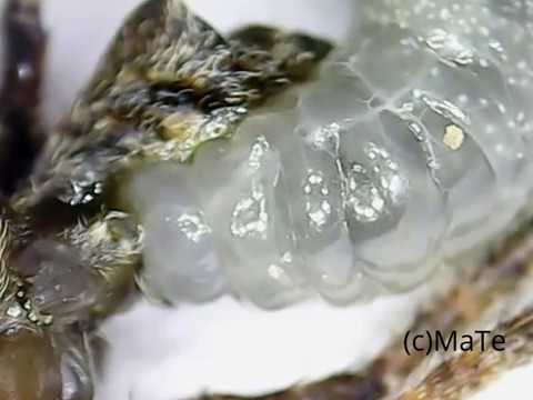 Il lyambliya al bambino da esser trattato a tutta la famiglia Come espellere vermi da intestini