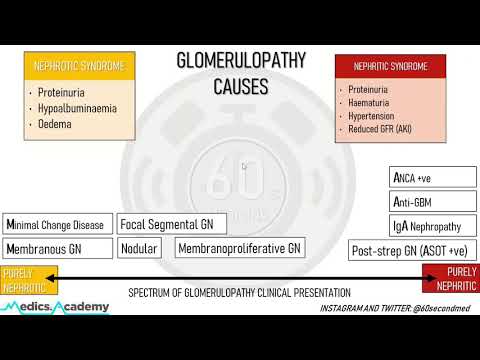 78 SECONDS on CAUSES of GLOMERULOPATHIES (Finally get your head around this!)