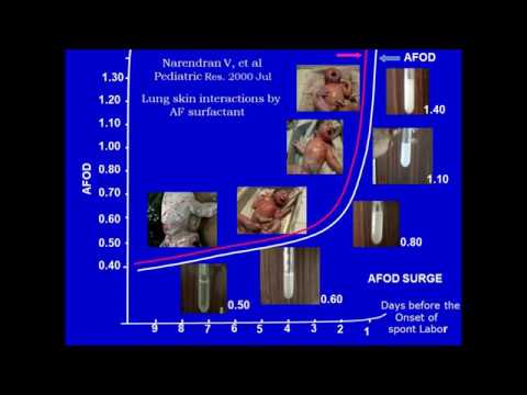 ‘Surge In Amniotic Fluid Optical Density’ Coincides With The Onset Of Spontaneous Labor - Part II
