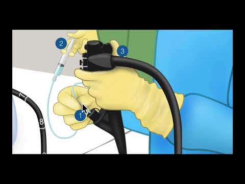 Colonoscopy: 1-2-3 Steps for Submucosal Injection - Graphic Illustration