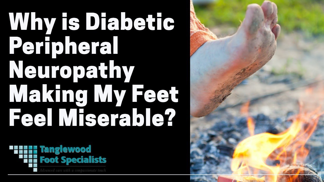 Why is Diabetic Peripheral Neuropathy Making My Feet Feel Miserable?