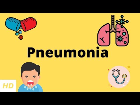 Pneumonia, Causes, Signs and Symptoms, Diagnosis and Treatment.