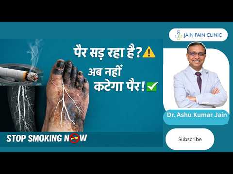 Watch video on vascular pain treatment