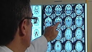 Brain injury linked to suicide, car accident risk
