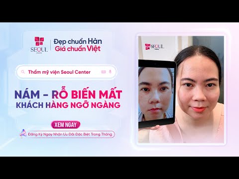 Nám, Sẹo Rỗ Biến Mất - Khách Hàng Ngỡ Ngàng Với Liệu Trình Tại Seoul Center!
