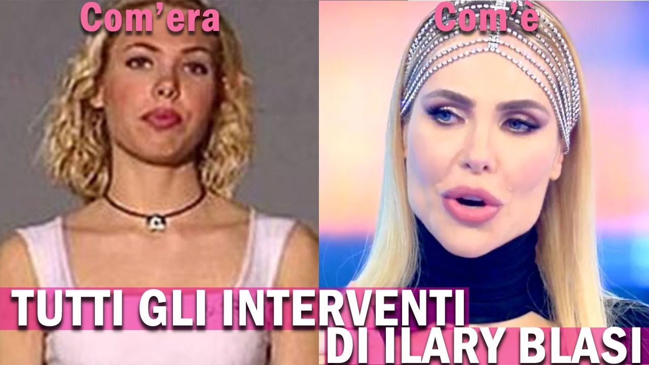 Watch Now Ilary Blasi stravolta dalla chirurgia! Prima e dopo i cambiamenti - Cosa ha combinato! Ilary Blasi stravolta dalla chirurgia! Prima e dopo i cambiamenti - Cosa ha combinato!