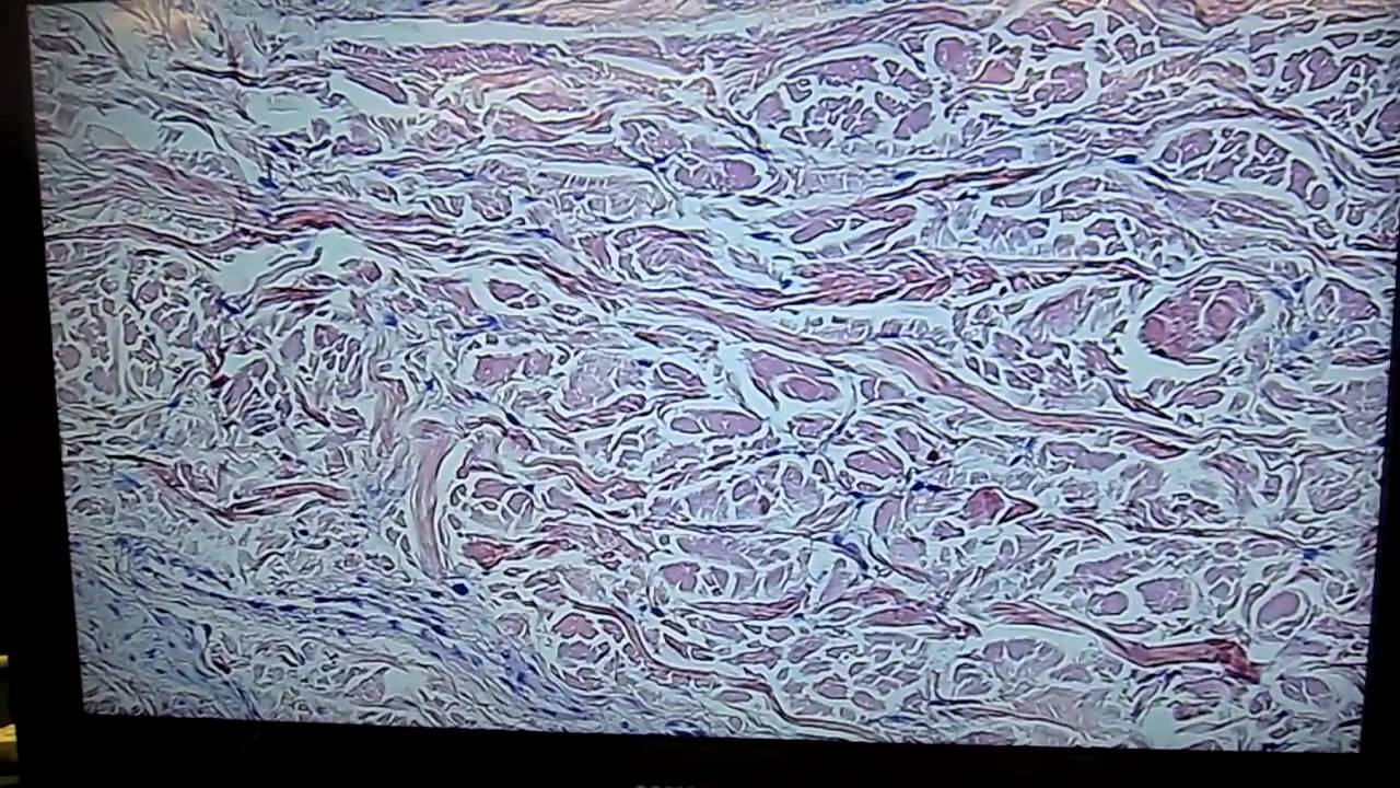 A&P 1 Lab#3 dense irregular connective tissue