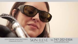 Skin Eleve