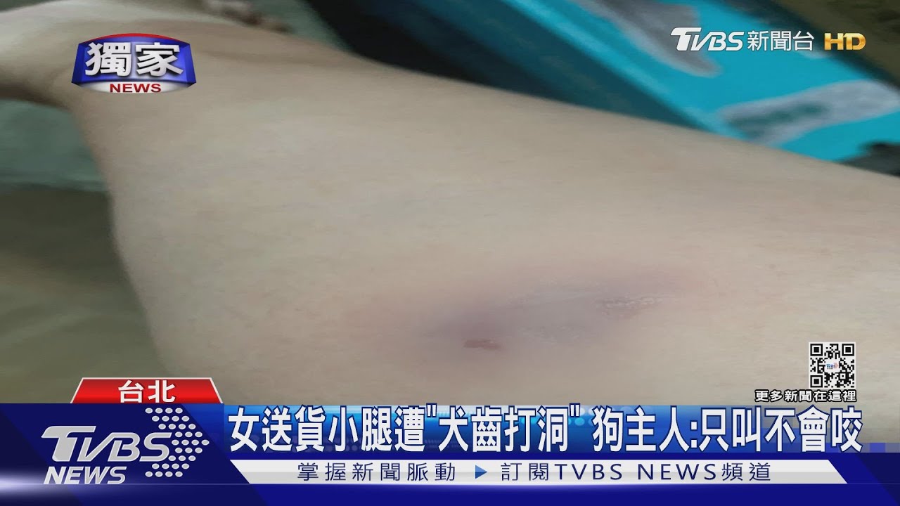 女送貨員小腿遭「犬齒打洞」 狗主人:只叫不會咬