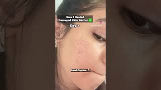 How I Healed My skin Barrier in 10 days 💕 #skincare #shorts #shortsvideo #skin #transformation