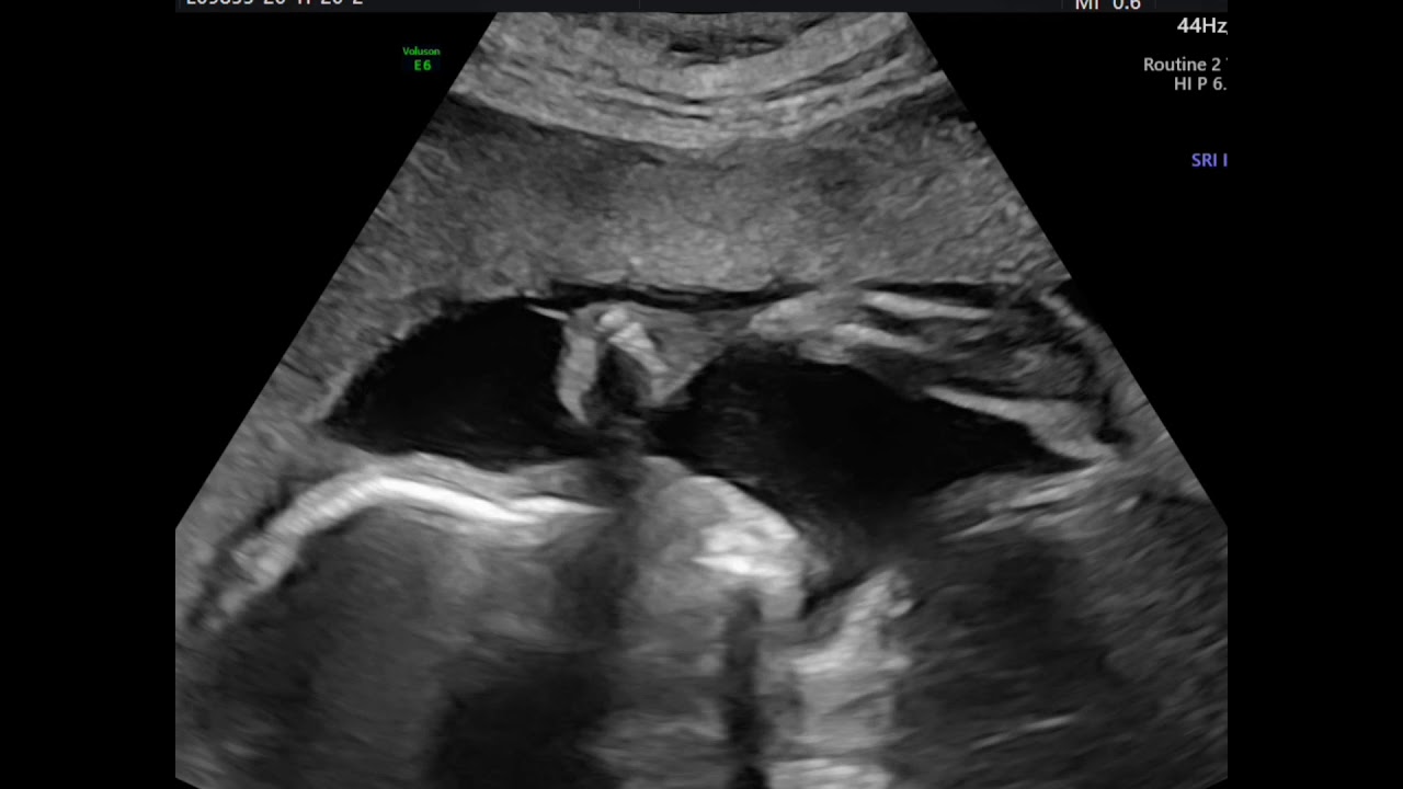 Cecilio Rodríguez Ayala-20