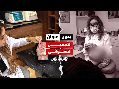 بدون عنوان: التجميل العشوائي من “إنستغرام” إلى غرف الإنعاش والمحاكم 