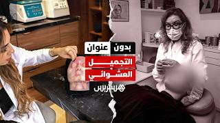 بدون عنوان: مصيدة التجميل العشوائي.. من إغراءات "إنستغرام" إلى غرف الإنعاش والمحاكم thumbnail