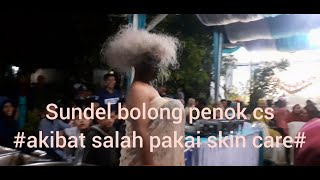 Download lagu SUNDEL BOLONG PENOK CS dengan judul #akibat salah pakai skin care# part 2 mp3 Download lagu SUNDEL BOLONG PENOK CS dengan judul #akibat salah pakai skin care# part 2 mp3