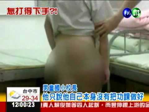 10歲童慘受虐 父母打到全身瘀青