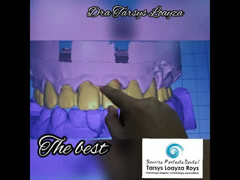 Smile design in Cartagena - Hi-tech dental office
