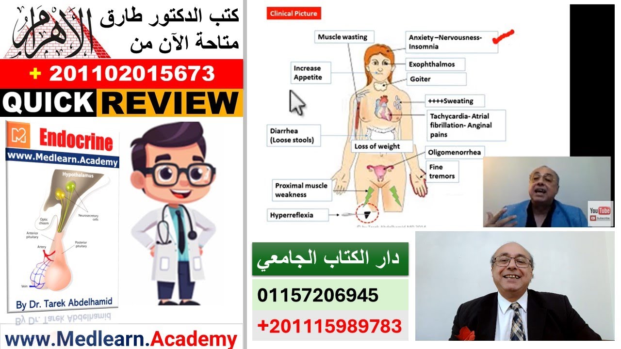 Hyperthyroidism [Thyrotoxicosis]  (Quick Review) #cme #internal_medicine #usmle #محاضرات_باطنة