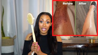 How To Treat Burns, Scars, Hyperpigmentation, or Dark Spots Fast and Naturally