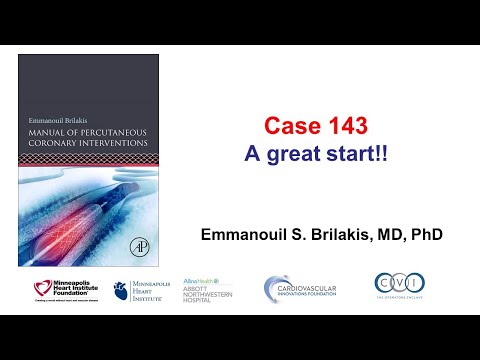 Case 143: PCI Manual - A great start!!