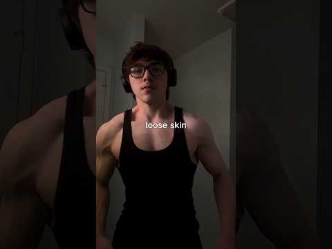 Loose Skin After Weightloss (150 Pounds) #gym #looseskin #weightloss #shorts