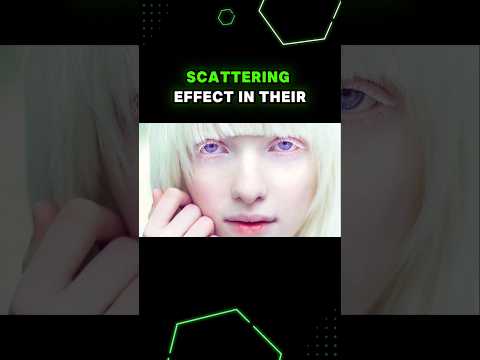 Red and Violet Eyes from Albinism!