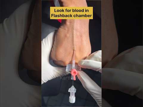 IV cannulation easy ! #anesthesia #doctor #anesthesiology #anaesthesia #anesthesiologist #nurse