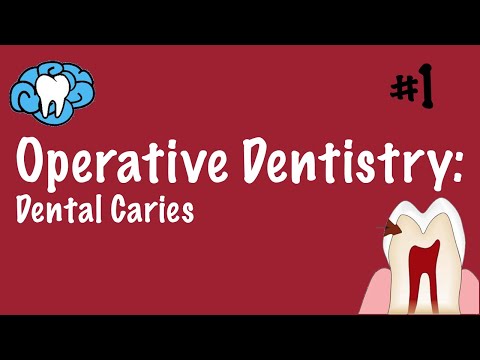 Operative Dentistry | Dental Caries | INBDE, ADAT