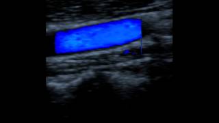 Kaixin DCU 10 color doppler ultrasound