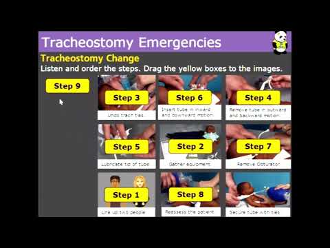 Thumbnail of YouTube video - Trach Change