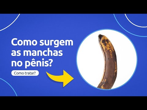 How do spots on the penis appear? How can they be treated?