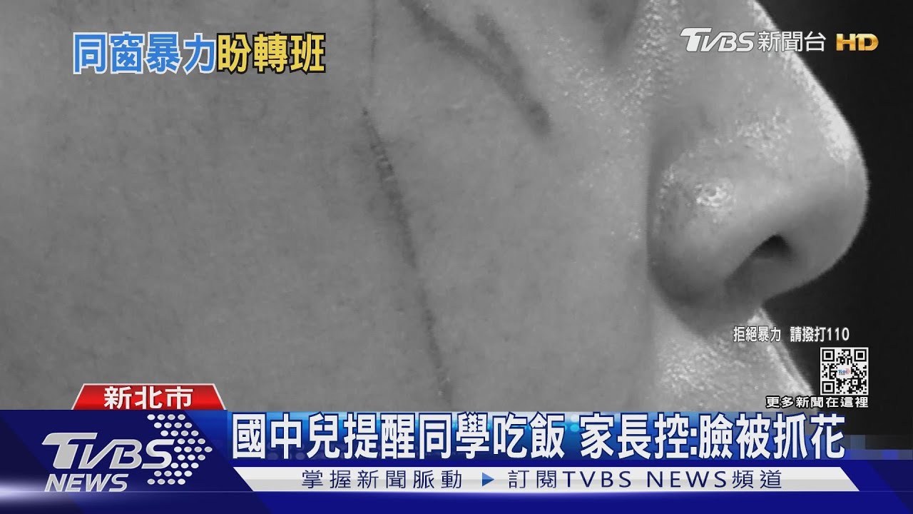 國中兒提醒同學吃飯　家長控：臉被抓花