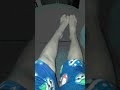 my legs