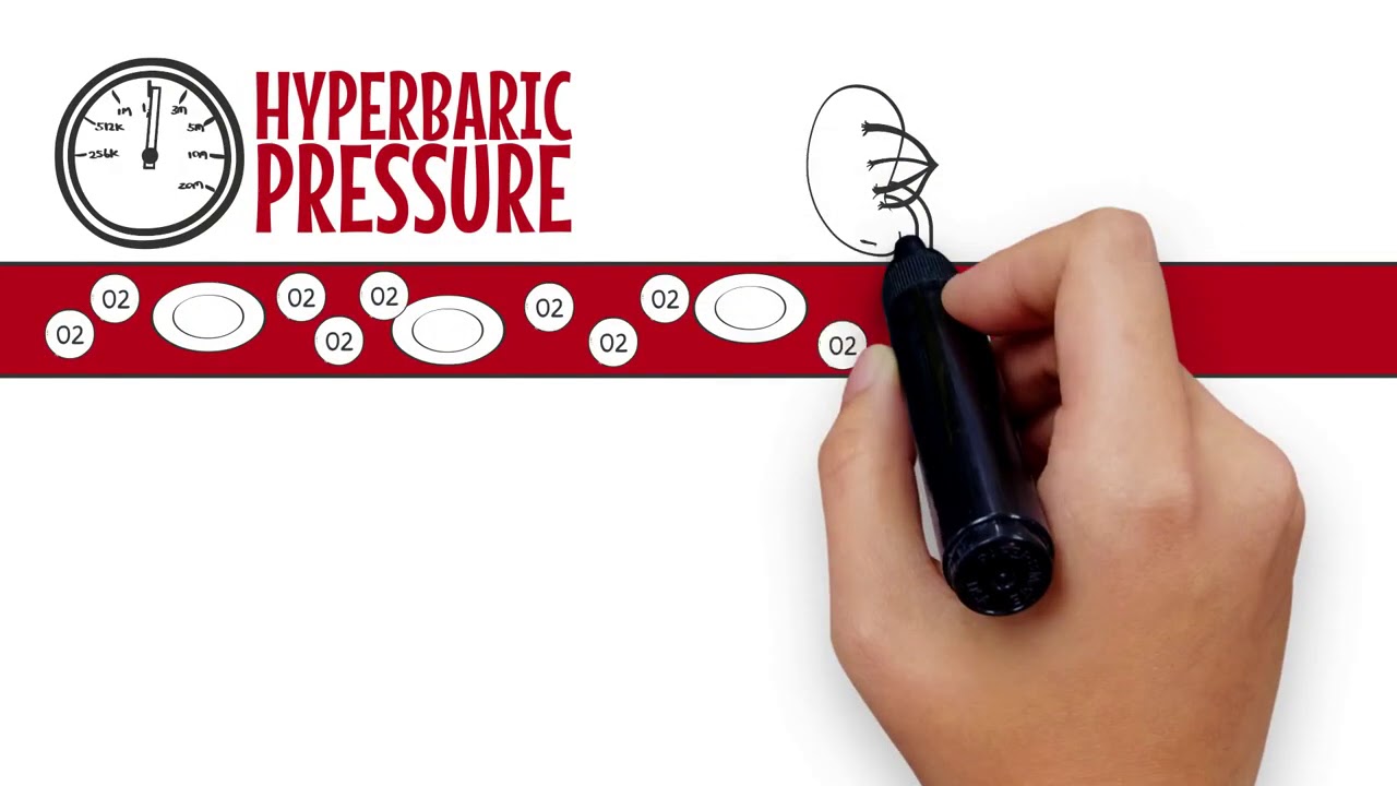 mHBOT for Recovery and Wellness