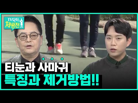 [TV닥터처방전] 티눈과 사마귀