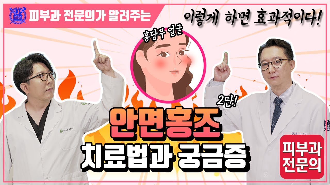 안면홍조 치료법과 궁금증