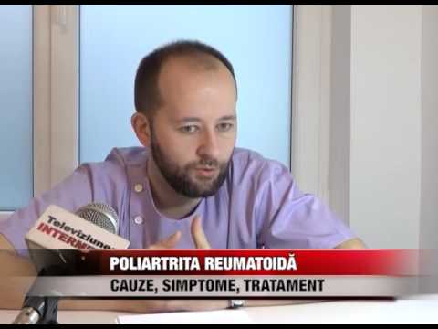 Tratamentul comun în România