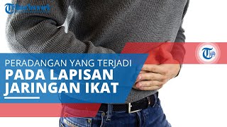 Peritonitis, Peradangan Bagian Peritoneum (Lapisan Jaringan Ikat yang Mengelilingi Organ Perut)