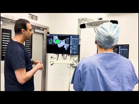 SMART Robotic Surgeon ™ | The Benefit of Mako Robotic Surgery