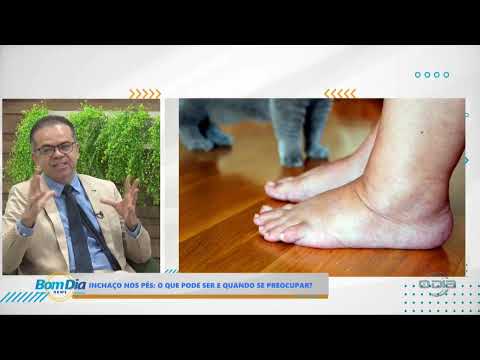 O Dia TV